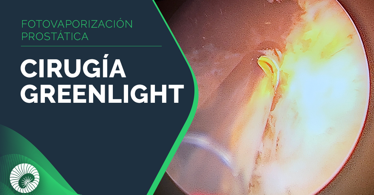 Foto vaporización Prostática con técnica GreenLight